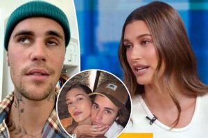 Read more about the article Hailey Bieber says Justin ‘is doing well’ amid facial paralysis
