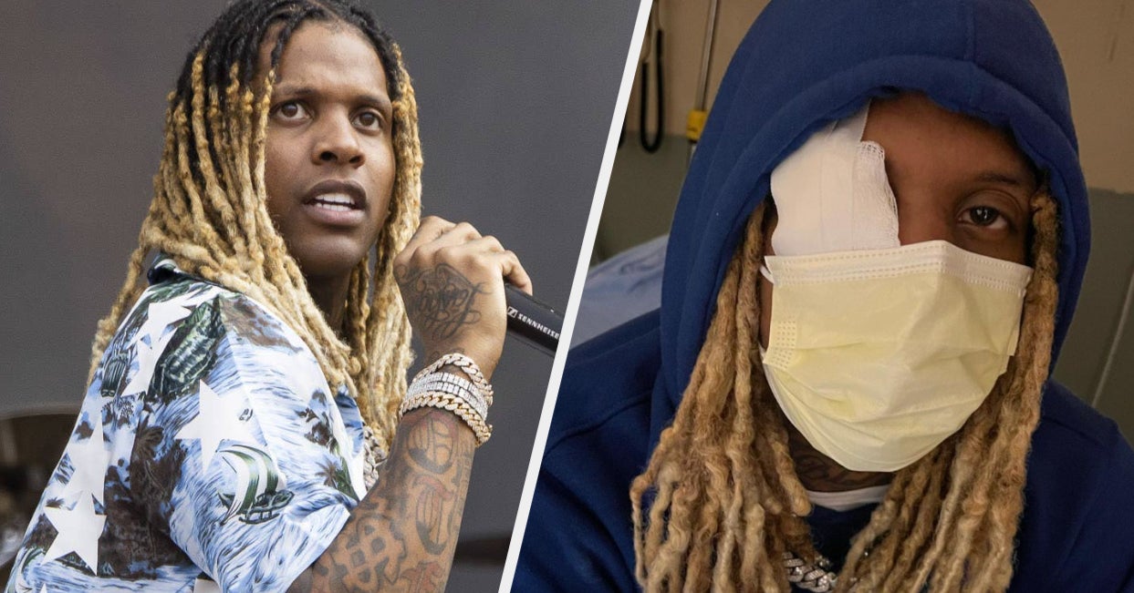 You are currently viewing Lil Durk Revealed His Condition After Explosives Went Off In His …