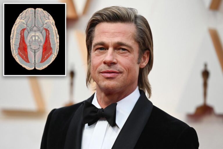 Read more about the article What is prosopagnosia? All about Brad Pitt’s face blindness condition